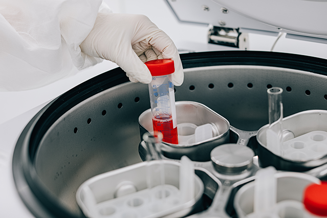 エクソバイタル