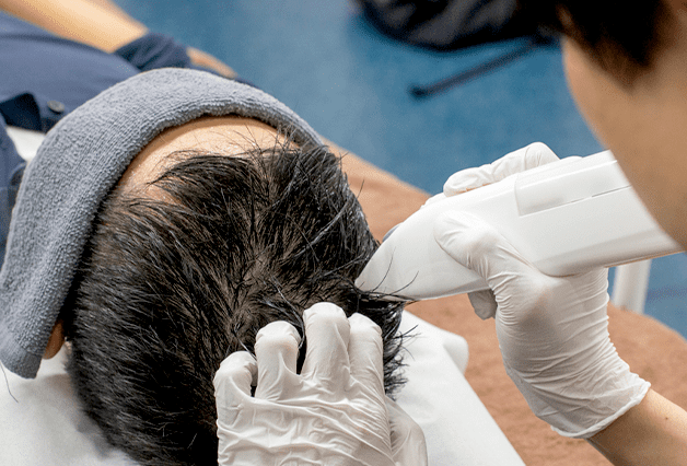 MINOXI JET（ミノキジェット）