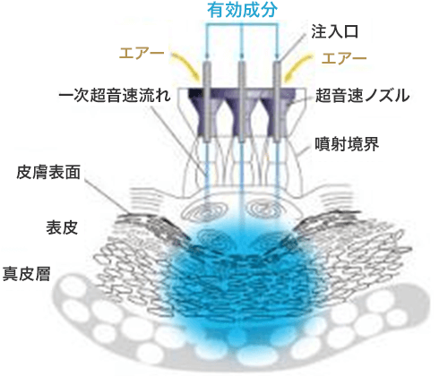 MINOXI JET（ミノキジェット）について