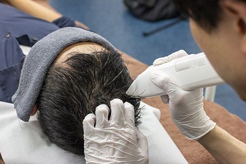 発毛させる治療法