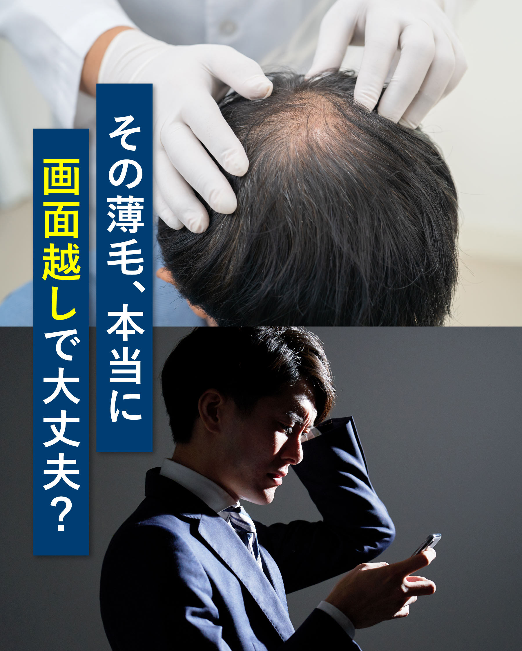 その薄毛、本当に画面越しで大丈夫？