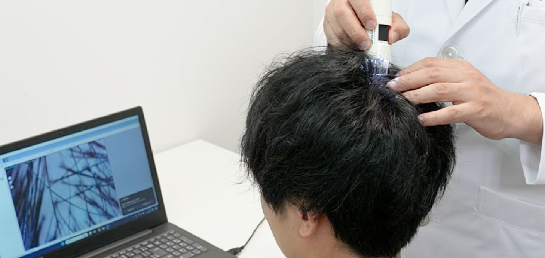 頭皮の健康診断